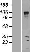 VENTX Protein (Over-Expression Lysate Myc-DDK (Flag))
