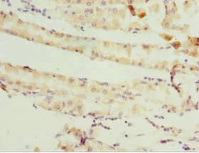 Polyclonal Rabbit anti-Human GSTZ1 Antibody (IHC, WB)