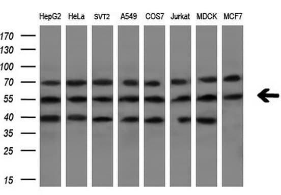 NR1H3 / LXR Alpha Antibody (aa69-329, clone OTI1A5)