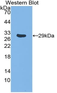 TRAF1 Antibody (aa169-392, HRP)
