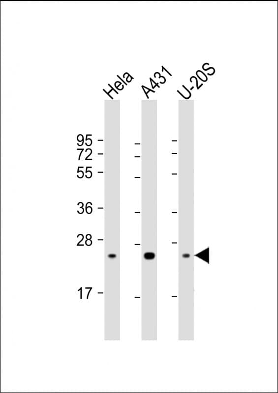 RAB1B Antibody (clone 1673CT667.16.73)
