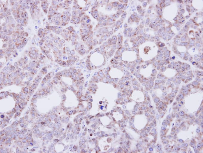 TMEM147 Antibody (aa37-131)