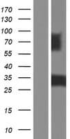 PDGF-BB Protein (Over-Expression Lysate Myc-DDK (Flag))