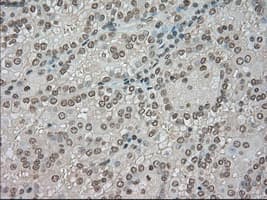BUB1B / BubR1 Antibody (clone OTI5D9)