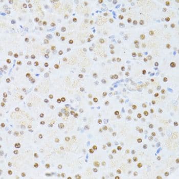 ER81 / ETV1 Antibody