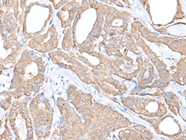 Polyclonal Rabbit anti-Human C9orf116 Antibody (IHC)