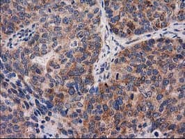 P5CR2 / PYCR2 Antibody (clone OTI2A12, Carrier-free)
