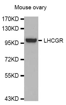 Polyclonal Rabbit anti-Human LHCGR / LHR / LH Receptor Antibody (WB)