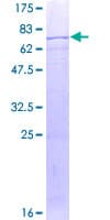 Human KMO Protein (Recombinant GST)