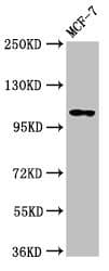 Polyclonal Rabbit anti-Human PSD Antibody (IHC, WB)