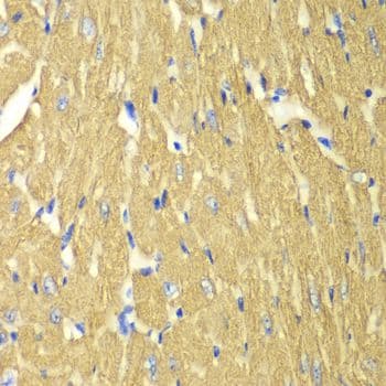 TPM3 Antibody