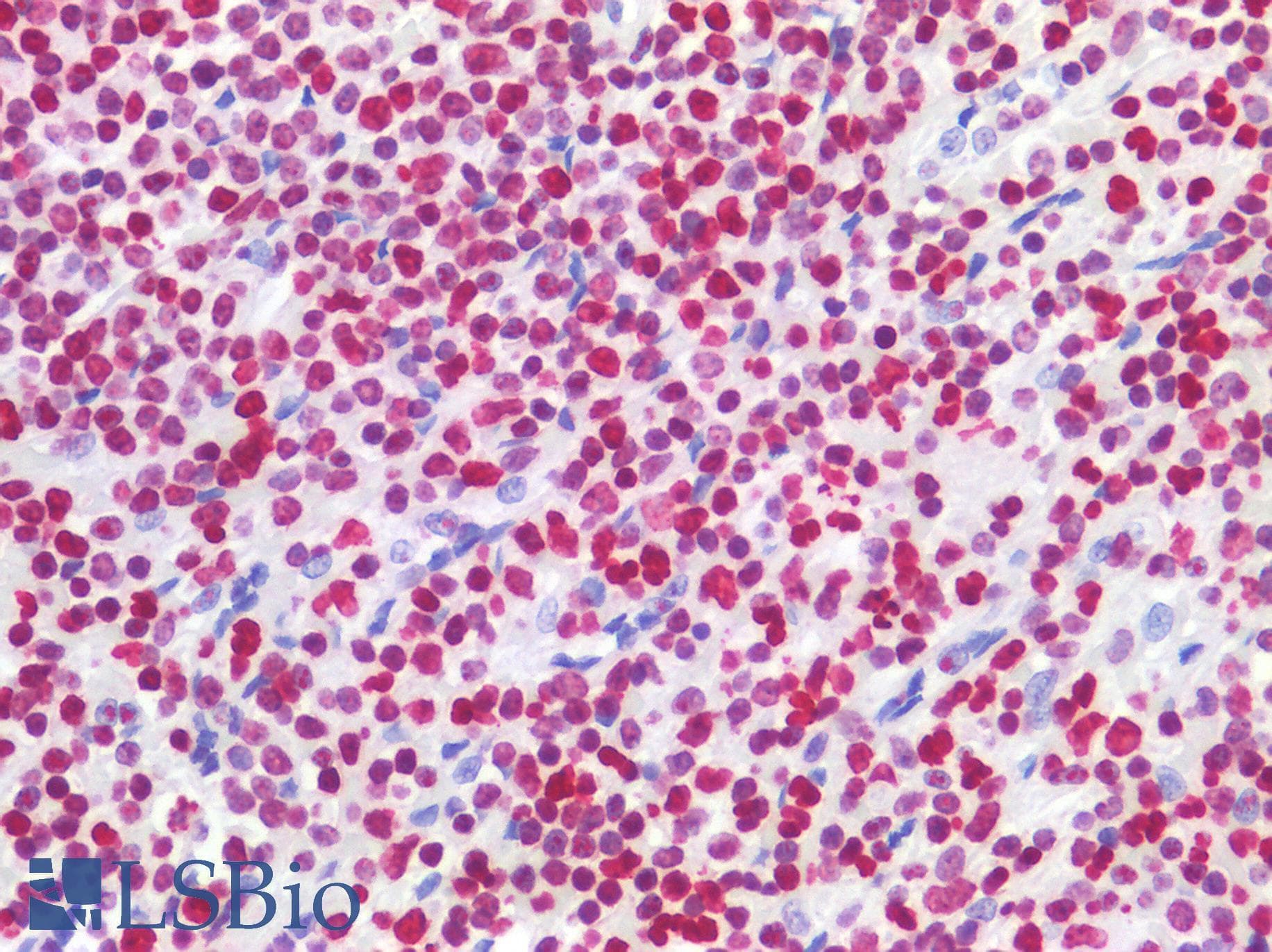 IHC-plus™ Polyclonal Rabbit anti-Human HIST1H1B Antibody (IHC, IF, WB)