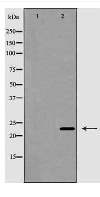 Polyclonal Rabbit anti-Human CD8B / CD8 Beta Antibody (WB)