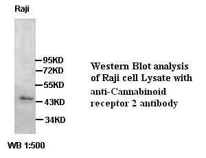 IHC-plus™ CNR2 / CB2 Antibody