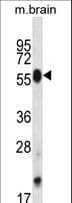 Polyclonal Rabbit anti-Mouse CLK4 Antibody (aa49-77, WB)