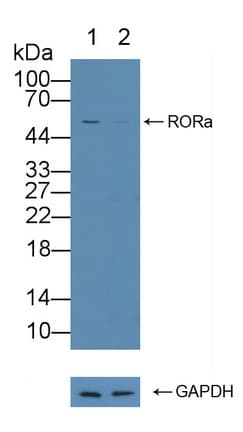 RORA / ROR Alpha Antibody (aa164-401)