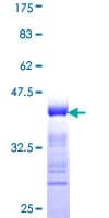 Human DIS3 Protein (Recombinant GST, N-terminus)