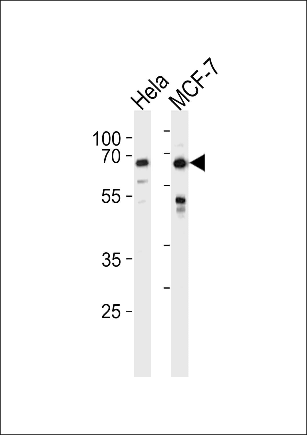 Polyclonal Rabbit anti-Human FOXO3 / FOXO3A Antibody (aa1-30, IHC, WB)