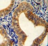 Polyclonal Rabbit anti-Human SAHH / AHCY Antibody (aa79-110, IHC, WB)