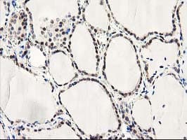 Latexin / MUM Antibody (clone OTI2G4, Carrier-free)