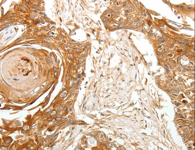 Polyclonal Rabbit anti-Human TERT / Telomerase Antibody (IHC)