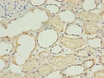 Polyclonal Rabbit anti-Human Trimethylguanosine Synthase 1 Antibody (aa713-853, IHC)