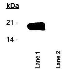 BIRC5 / Survivin Antibody (phospho-Thr34, Biotin)