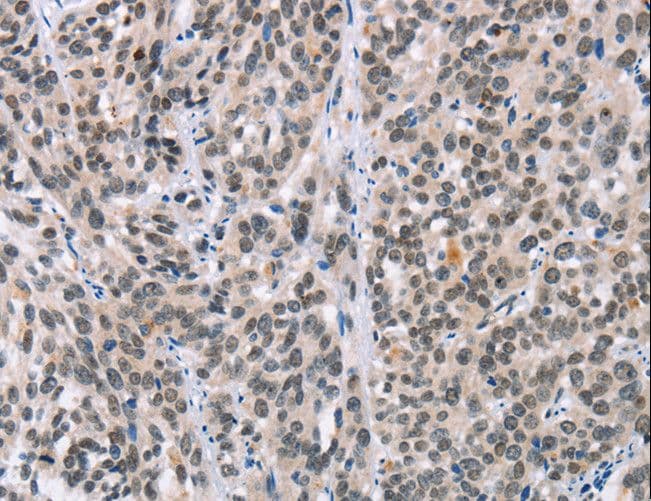 Polyclonal Rabbit anti-Human ADNP Antibody (IHC)