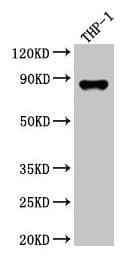 GSN / Gelsolin Antibody (aa28-782)
