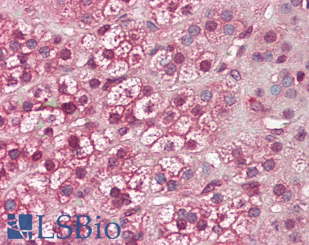 IHC-plus™ MMP11 Antibody