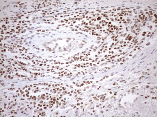 MGMT Antibody (clone OTI5A7)