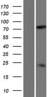DDHD2 Protein (Over-Expression Lysate Myc-DDK (Flag))