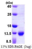 Human S100A3 / S100E Protein (Recombinant His)