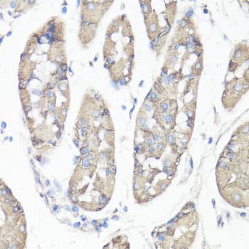 FAK / Focal Adhesion Kinase Antibody