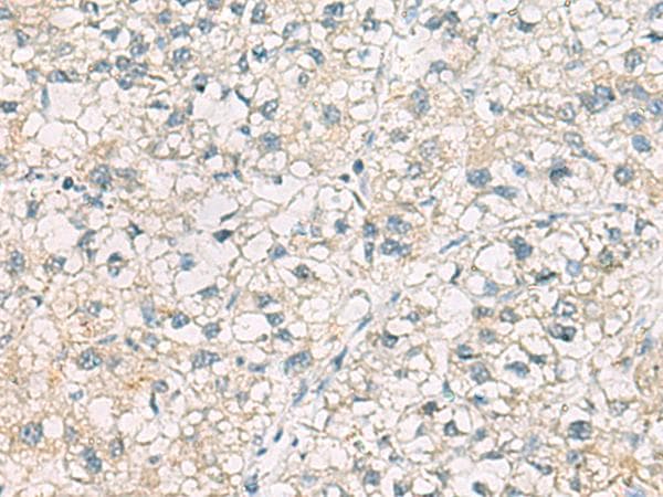 CHMP6 Antibody
