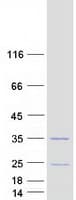 Human SPIN2B Protein (Recombinant Myc-DDK (Flag))