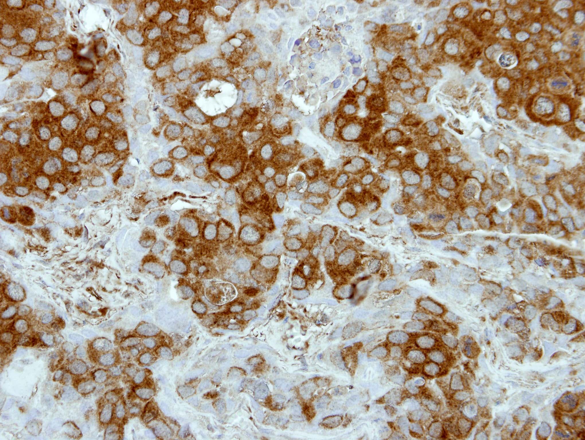Polyclonal Rabbit anti-Human DTX1 / Deltex Antibody (aa343-617, IHC, WB)