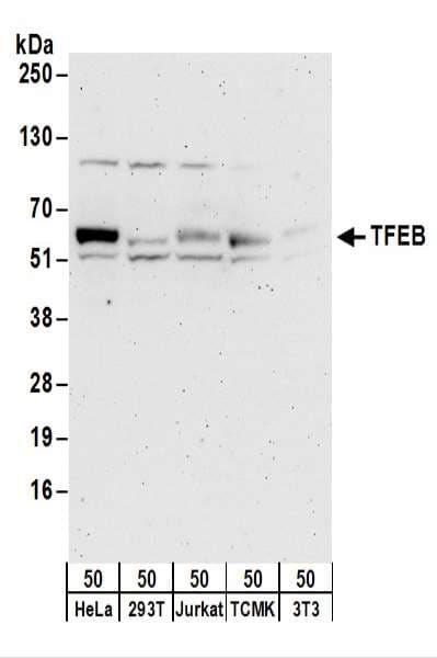TFEB Antibody (aa426-476)