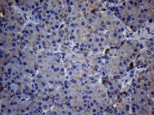 TNFRSF10B / Killer / DR5 Antibody (aa203-411, clone OTI5G5)
