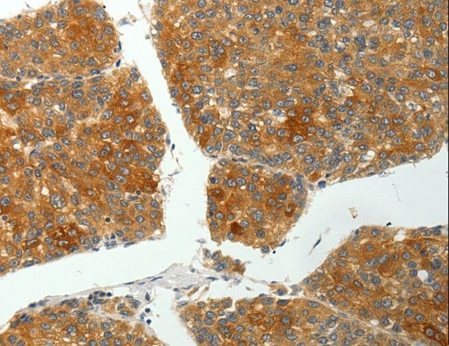 Polyclonal Rabbit anti-Human PTPN6 / SHP1 Antibody (IHC, WB)