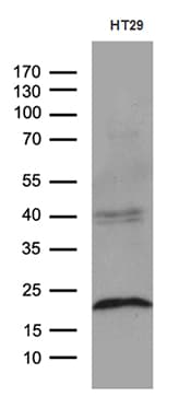 CIB1 / KIP Antibody (aa2-191, clone OTI1B8)