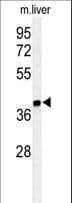 Polyclonal Rabbit anti-Human ISM1 Antibody (aa435-464, IHC, WB)