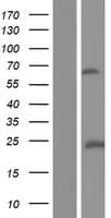 Human ABLIM2 Protein (Over-Expression Lysate Myc-DDK (Flag))