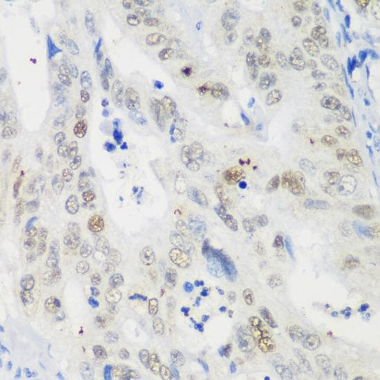TP53 / p53 Antibody