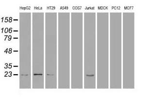 AK1 / Adenylate Kinase 1 Antibody (clone OTI5G8)