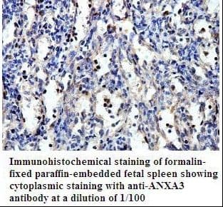 Polyclonal Rabbit anti-Human ANXA3 / Annexin A3 Antibody (aa2-207, IHC, WB)