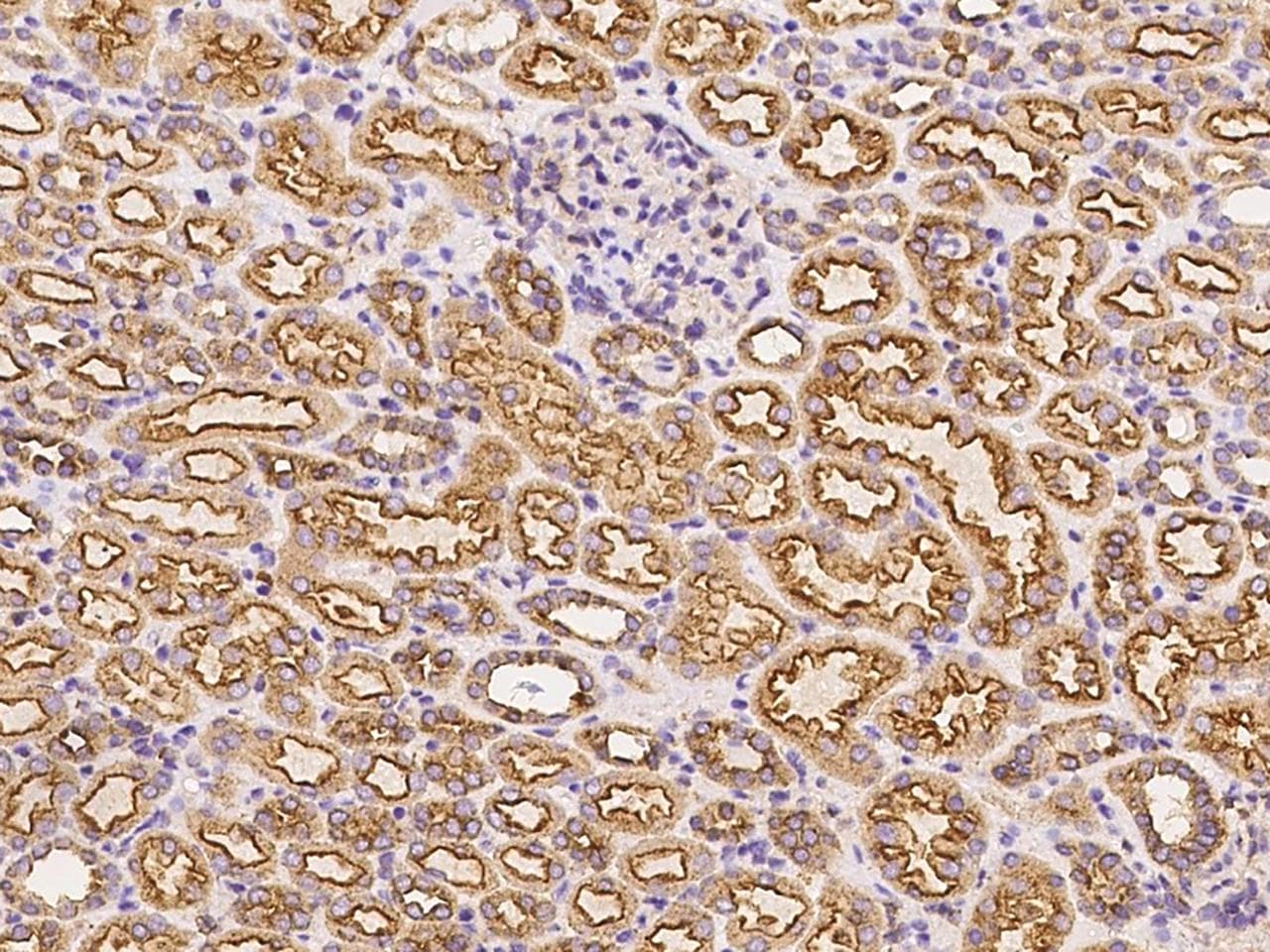 Polyclonal Rabbit anti-Mouse CLTC / Clathrin Heavy Chain Antibody (Preservative Free, IHC, WB)