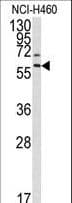 MMP17 Antibody (aa391-420)