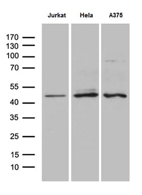 NFKBIE / IKB Epsilon Antibody (clone OTI6G9)