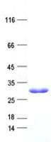 Human C6orf106 Protein (Recombinant His, N-Terminal)